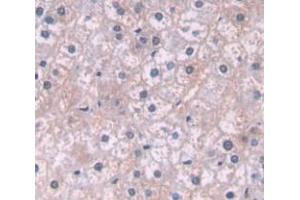 IHC-P analysis of Human Tissue, with DAB staining. (ITGA2 Antikörper  (AA 74-277))