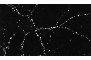 ICC of PSD95 in cultures of dissociated hippocampal neurons. (DLG4 Antikörper  (Biotin))