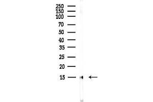 Western blot analysis of lysates from EC304 cells(heat-shock,45 min treatment), using Phospho-Histone H3 (Ser28) Antibody at 1/1000 dilution.
