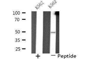 Western blot analysis of extracts from K562 cells using PP4R2 antibody. (PPP4R2 Antikörper  (Internal Region))