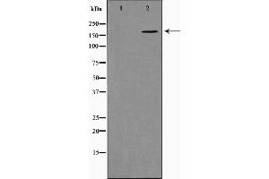 Western blot analysis on K562 cell lysate using Collagen XIalpha 1 Antibody，The lane on the left is treated with the antigen-specific peptide. (COL11A1 Antikörper  (Internal Region))