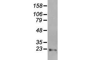 Western blot analysis of 35 µg of cell extracts from human (HeLa) cells using anti-AK1 antibody. (Adenylate Kinase 1 Antikörper)