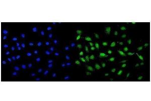 IF analysis of MCAK using anti-MCAK antibody (ABIN3043278). (KIF2C Antikörper  (AA 531-725))