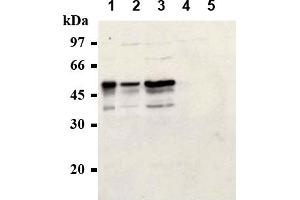 Western Blotting (WB) image for anti-Cyclin E1 (CCNE1) antibody (ABIN567783) (Cyclin E1 Antikörper)