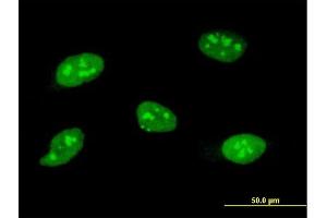 Immunofluorescence of monoclonal antibody to SOCS3 on HeLa cell.