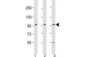 Western blot testing of human 1) HepG2, 2) PC-3 and 3) U-87 MG cell lysate with PCDH10 antibody at 1:2000. (PCDH10 Antikörper  (AA 128-160))