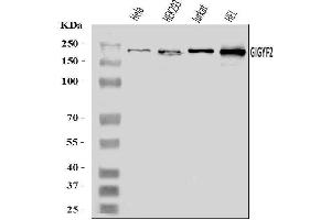 Western blot analysis of GIGYF2 using anti-GIGYF2 antibody (ABIN7601679).