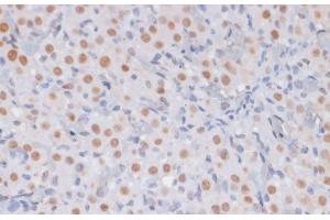 Immunohistochemistry of paraffin-embedded Rat ovary using TriMethyl-Histone H3-K27 Polyclonal Antibody at dilution of 1:100 (40x lens). (Histone 3 Antikörper  (3meLys27))