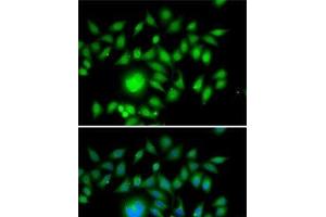 Immunofluorescence analysis of MCF7 cells using ATOH1 Polyclonal Antibody (ATOH1 Antikörper)