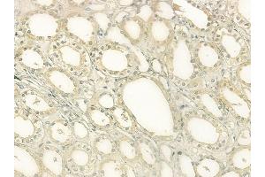 ABIN6265131 and ABIN6277621 at 1/100 staining human normal kidney tissue by IHC-P.