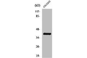 Western Blot analysis of COLO205 cells using Rhodopsin Polyclonal Antibody (Rho-related GTP-binding protein Antikörper)