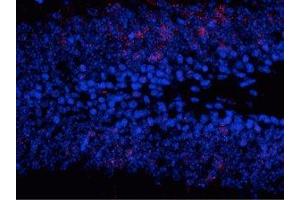 Immunostaining of granule cells in the dentate gyrus of saline treated mouse showing (MAPK1/2 (pThr202), (pTyr204) Antikörper)