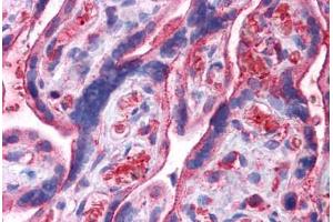 Human Placenta: Formalin-Fixed, Paraffin-Embedded (FFPE) (UCHL3 Antikörper  (N-Term))