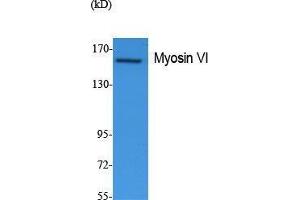 Western Blotting (WB) image for anti-Myosin VI (MYO6) (N-Term) antibody (ABIN3178103) (Myosin VI Antikörper  (N-Term))