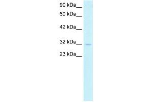 WB Suggested Anti-SIRT5 Antibody Titration:  1. (SIRT5 Antikörper  (Middle Region))