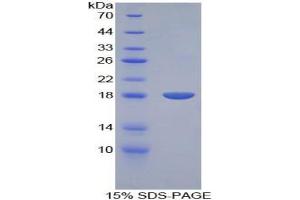 SDS-PAGE analysis of Rat BMP15 Protein. (BMP15 Protein)