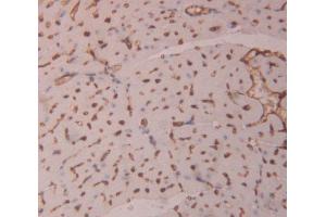 Used in DAB staining on fromalin fixed paraffin- embedded heart tissue (HIPK1 Antikörper  (AA 1-290))
