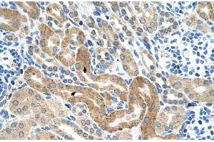 Human kidney (CHAF1B Antikörper  (C-Term))
