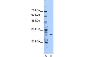 WB Suggested Anti-METTL1 Antibody Titration:  2. (METTL1 Antikörper  (Middle Region))