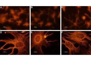 Expression of CNGA2 in rat cerebellum primary culture  - Immunocytochemical staining of paraformaldehyde-fixed and permeabilized rat cerebellum primary culture. (CNGA2 Antikörper  (Intracellular))