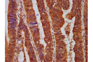 Immunohistochemistry (IHC) image for anti-Protein Phosphatase 2, Regulatory Subunit B', epsilon Isoform (PPP2R5E) (AA 2-149), (Regulatory Subunit) antibody (ABIN7169254)