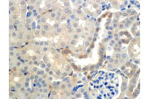 Immunohistochemistry analysis using Mouse Anti-ENaC beta Monoclonal Antibody, Clone 7B8 . (SCNN1B Antikörper  (AA 617-638) (FITC))