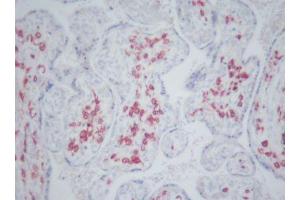 Image no. 3 for anti-CD163 (CD163) antibody (ABIN379967) (CD163 Antikörper)