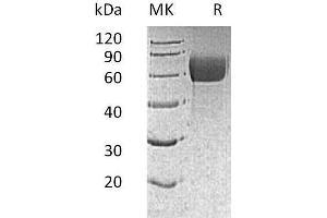 Western Blotting (WB) image for Interleukin 13 Receptor, alpha 1 (IL13RA1) protein (His tag,AVI tag) (ABIN7320865) (IL13 Receptor alpha 1 Protein (His tag,AVI tag))