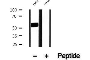 Western blot analysis of extracts of HeLa cells, using DMAP1 antibody. (DMAP1 Antikörper  (Internal Region))