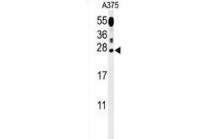 Western Blotting (WB) image for anti-Inosine Triphosphatase (ITPA) antibody (ABIN3002176) (ITPA Antikörper)
