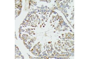 Immunohistochemistry of paraffin-embedded mouse testis using HSP70/HSP antibody (2948) at dilution of 1:100 (40x lens). (HSP70 1A Antikörper  (AA 500-600))