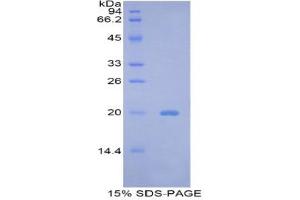 SDS-PAGE (SDS) image for BCL2-Like 2 (BCL2L2) (AA 22-189) protein (His tag) (ABIN1877891)