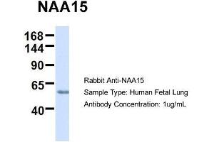 Host:  Rabbit  Target Name:  NAA15  Sample Type:  Human Fetal Lung  Antibody Dilution:  1. (NAA15 Antikörper  (N-Term))