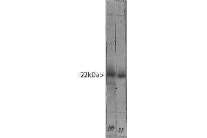 Western blot of bovine cerebellum homogenate stained with ABIN1580472 in lane 11. (VSNL1 Antikörper)