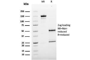 SDS-PAGE Analysis Purified MCAM Mouse Monoclonal Antibody (MCAM/3179). (MCAM Antikörper)
