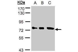 WB Image Sample(30 ug whole cell lysate) A:A431, B:H1299 C:Hep G2 , 10% SDS PAGE antibody diluted at 1:2000 (OPTN Antikörper)