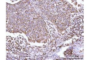IHC analysis of ECHS1 using anti-ECHS1 antibody (ABIN7599813).