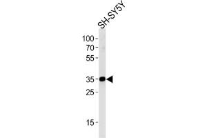 Western Blotting (WB) image for anti-Syntaxin 1B (STX1B) antibody (ABIN3004757) (Syntaxin 1B Antikörper)
