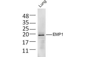 Mouse lung lysates probed with EMP1 Polyclonal Antibody, Unconjugated  at 1:300 dilution and 4˚C overnight incubation. (EMP1 Antikörper  (AA 101-160))