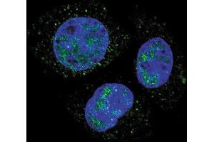 Confocal immunofluorescent analysis of Phospho-Rb- Antibody (ABIN389648 and ABIN2839638) with HepG2 cell followed by Alexa Fluor 488-conjugated goat anti-rabbit lgG (green). (Retinoblastoma 1 Antikörper  (pSer811))