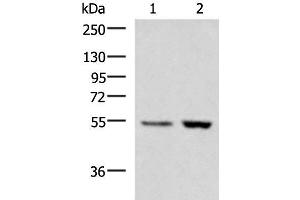 Western blot analysis of Human placenta tissue LOVO cell lysates using ZSWIM1 Polyclonal Antibody at dilution of 1:550 (ZSWIM1 Antikörper)