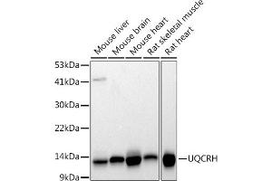 UQCRH 抗体
