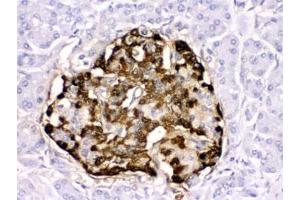 IHC testing of human pancreatic cancer tissue with GLP-1 antibody. (GLP-1 Antikörper)