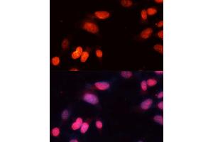 Immunofluorescence analysis of NIH-3T3 cells using SIRT1 Polyclonal Antibody (ABIN3020730, ABIN3020731, ABIN3020732, ABIN1513524 and ABIN6213695) at dilution of 1:100 (40x lens). (SIRT1 Antikörper)