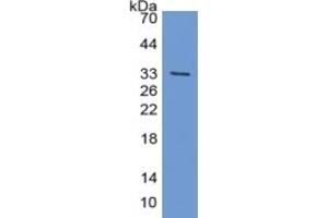 Rabbit Detection antibody from the kit in WB with Positive Control: Sample Human Skeletal muscle lysate. (Cardiac Troponin T2 CLIA Kit)