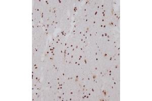 Immunohistochemical analysis of (ABIN1539554 and ABIN2849696) on paraffin-embedded human brain tissue was performed on the Leica®BOND RXm. (OTUD7A Antikörper  (N-Term))