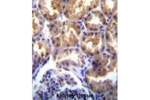 Immunohistochemistry (IHC) image for anti-Transient Receptor Potential Cation Channel, Subfamily M, Member 6 (TRPM6) antibody (ABIN3003652) (TRPM6 Antikörper)