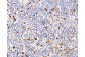 Immunohistochemistry analysis of parafffin-embedded mouse spleen using Lysozyme Polyclonal Antibody at dilution of 1:400. (LYZ Antikörper)