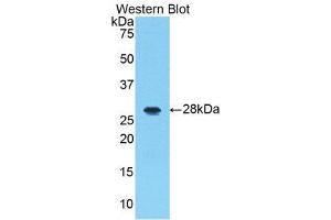Western Blotting (WB) image for anti-Interleukin-1 Receptor-Associated Kinase 1 (IRAK1) (AA 212-440) antibody (ABIN3206503) (IRAK1 Antikörper  (AA 212-440))