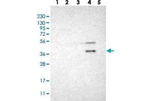 Western blot analysis of Lane 1: RT-4, Lane 2: U-251 MG, Lane 3: Human Plasma, Lane 4: Liver, Lane 5: Tonsil with WNT7A polyclonal antibody .